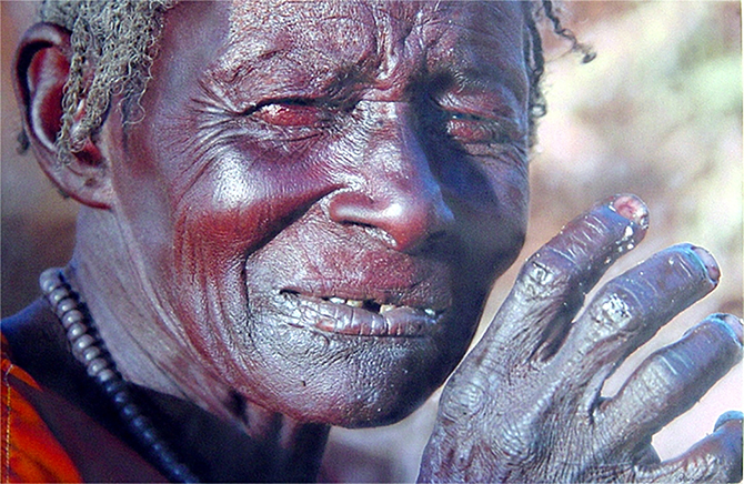 Hyperrealism painting Don't Shed No Tears by Denis Peterson